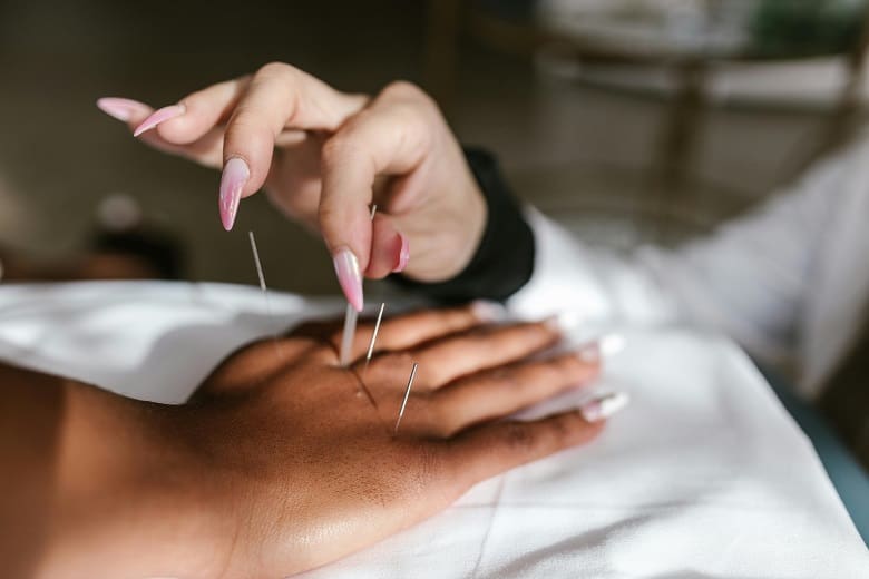 A person undergoing acupuncture treatment after a hysterectomy.