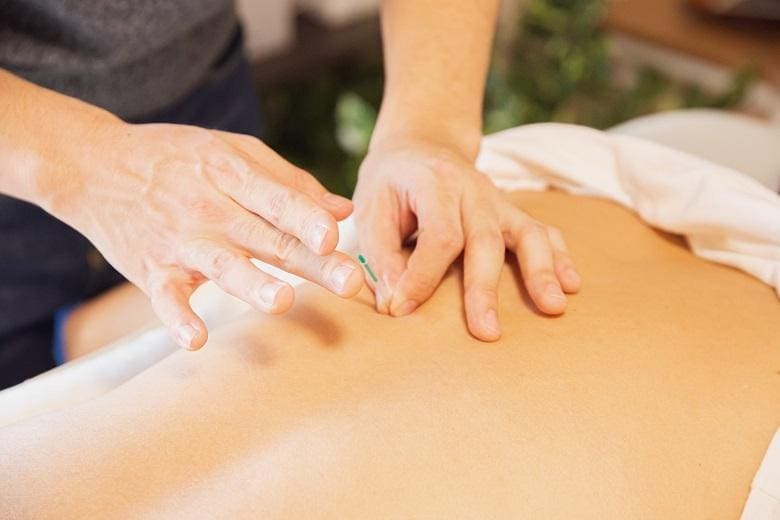 A woman receiving an acupuncture treatment for her back at a spa.