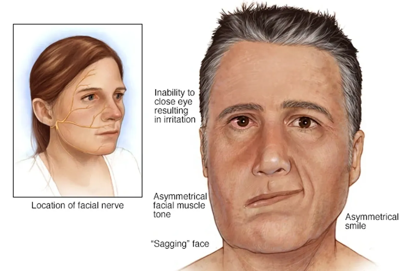 A man's face is shown before and after surgery.