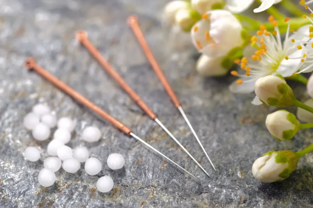 Acupuncture needles on a stone surface.