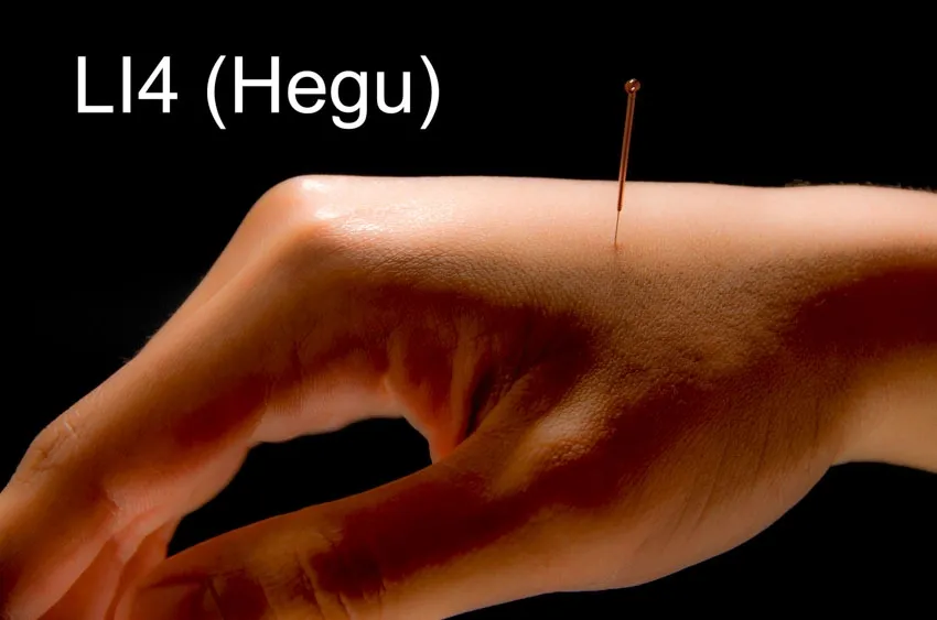 A person's hand with an acupuncture needle on it, targeting sinus pressure for relief.