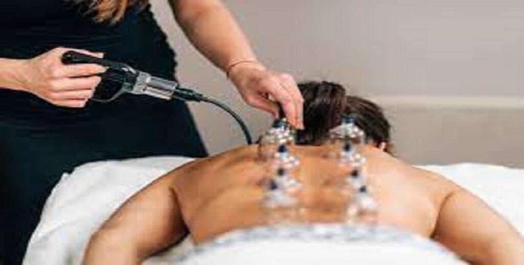 A woman receiving acupuncture in a massage room.