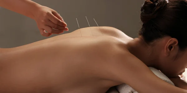 A woman receiving acupressure in a massage room at an acupuncture clinic in Brooklyn.