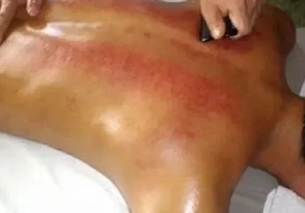 A man getting a back massage.