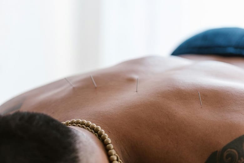 A man is receiving acupressure treatment on his back.