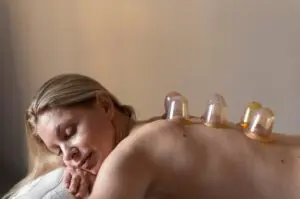 Hijama Cupping Therapy