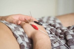 Acupuncture in Bay Ridge