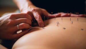 acupuncture for back pain