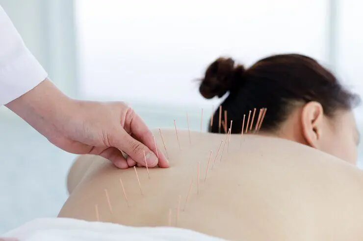 Bonafide Acupuncture