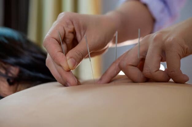 Chinese Acupuncture