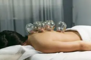 Hijama Cupping Therapy