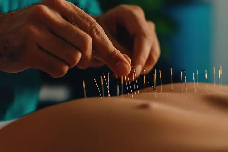 Bonafide Acupuncture | Acupuncture and the Path to Optimal Health: Integrating Ancient Practices into Your Life Classical Chinese Acupuncture