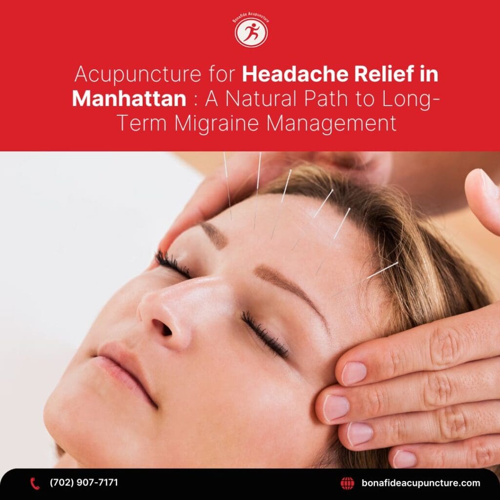 Acupuncture