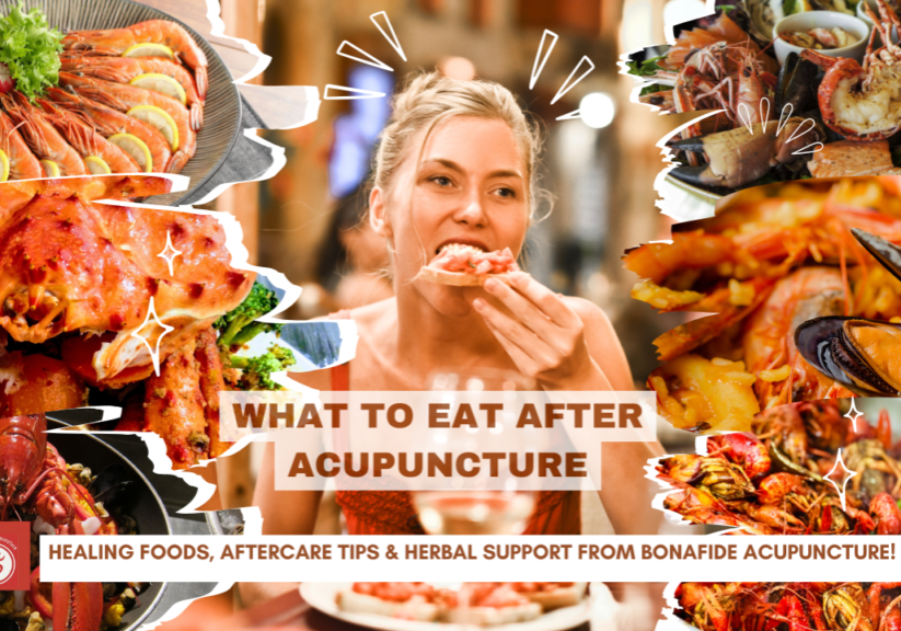 Acupuncture Acupuncture
