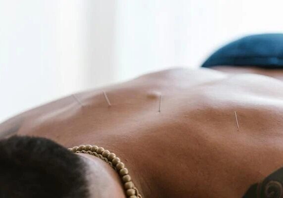 Acupuncture and Massage