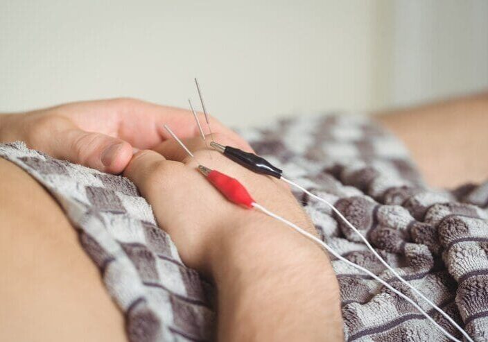 Acupuncture in Bay Ridge