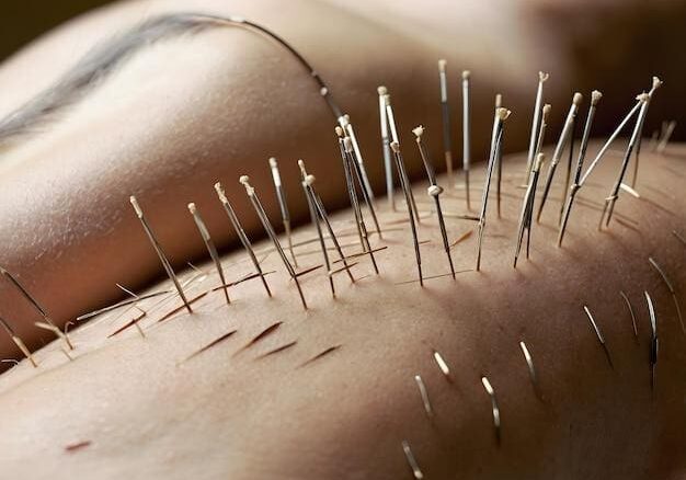 Fertility Acupuncture