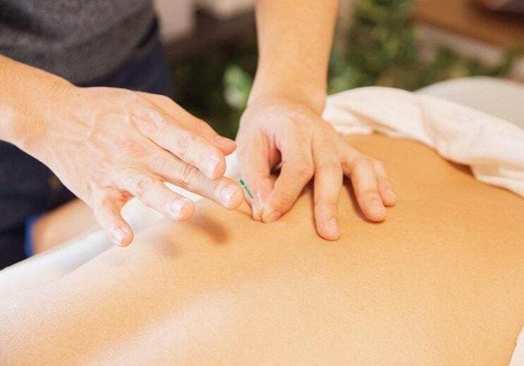 A woman receiving an acupuncture treatment for her back at a spa.