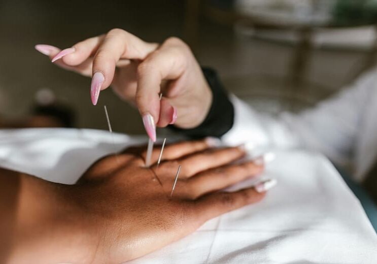 A person undergoing acupuncture treatment after a hysterectomy.